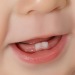 دندان های کودک