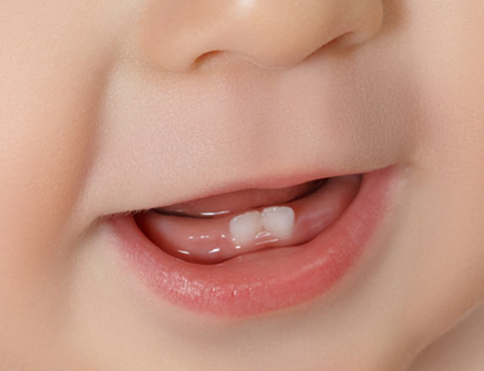 دندان های کودک خود را سالم نگه دارید